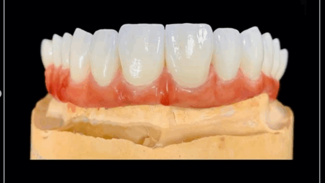 Ceramix Dent